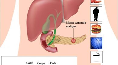 Cancro_pancreas